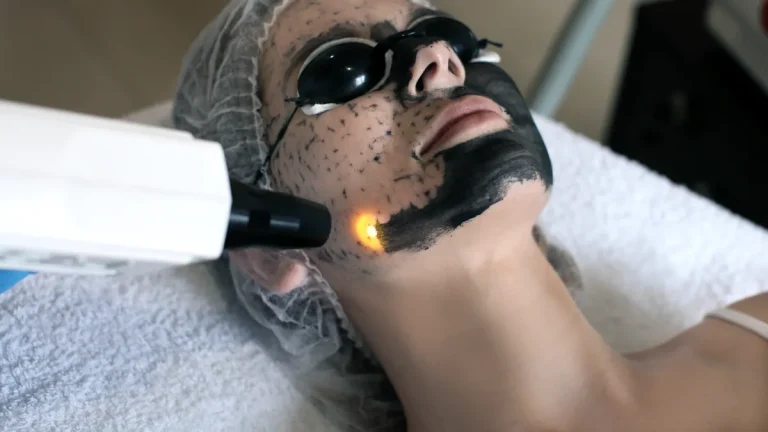 laserpeeling utförs