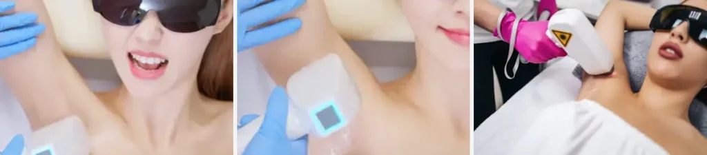 Lasertyper som används för medicinska behandlingar