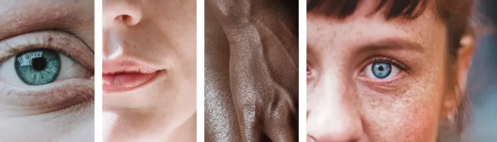 Misslyckande att uppnå förväntat resultat efter laserbehandling