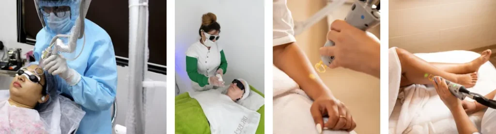 Nd för behandling av åderbråck och kärlproblem