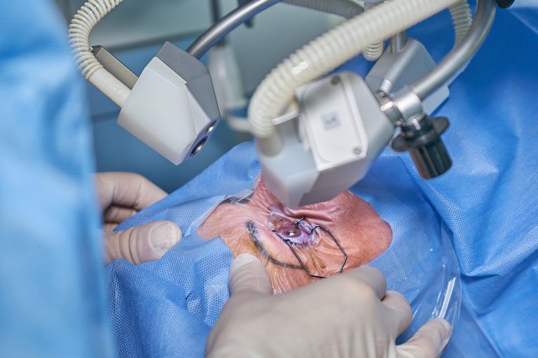 ögonlaseroperation