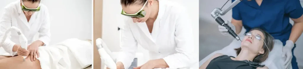 Onormala blodkärl eller kärlsjukdomar efter laserbehandling