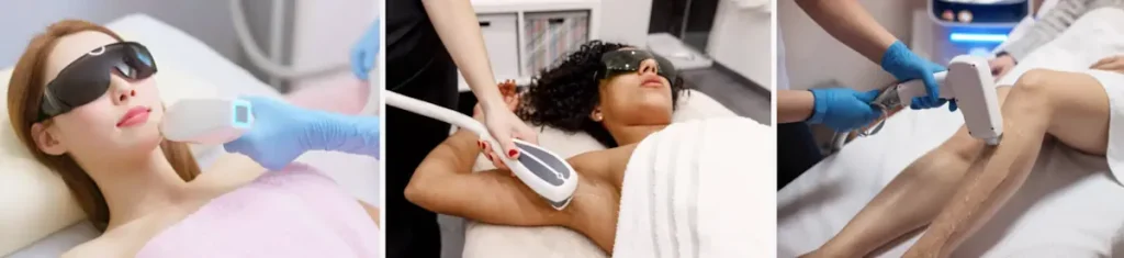 Oönskad hudförtjockning efter laserbehandling