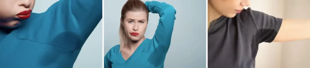 Överdriven svettning efter laserbehandling