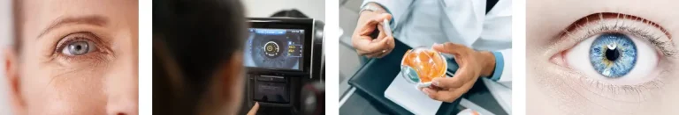 Sår eller skador på hornhinnan efter ögonlaseroperationer