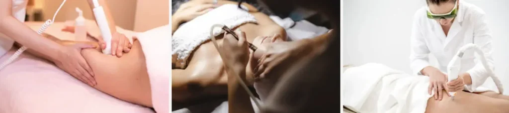 Tillfällig eller permanent förändring i känseln efter laserbehandling