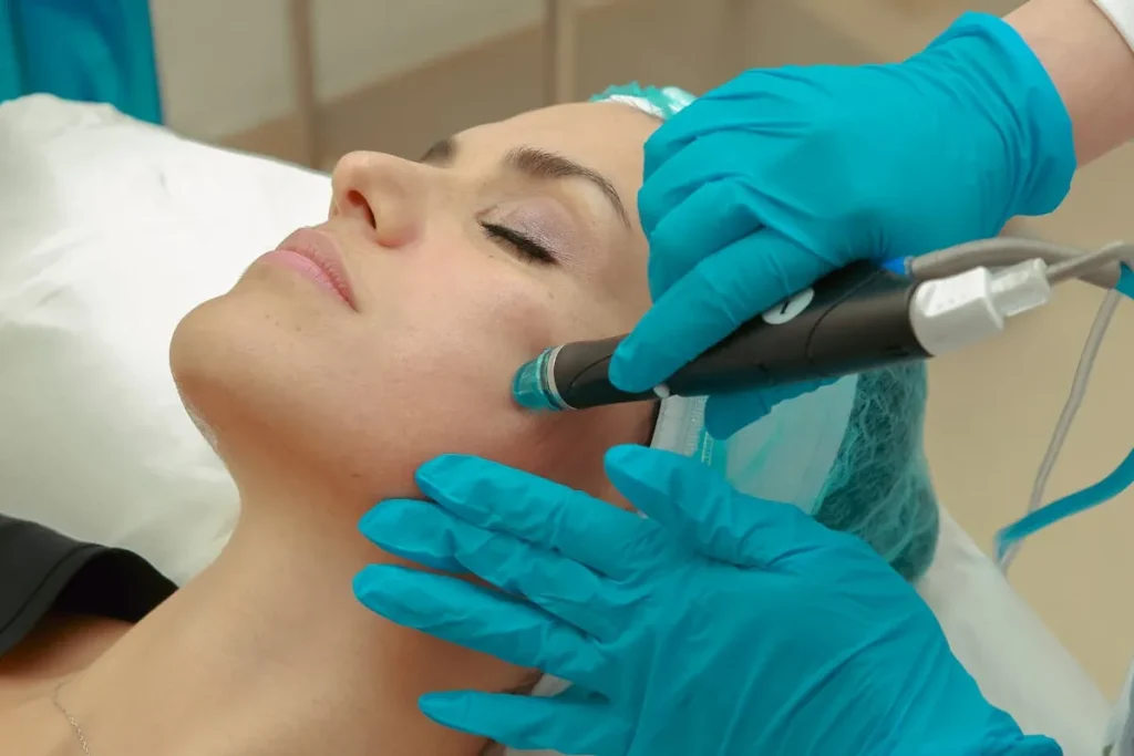 torrhet i huden efter laserbehandling