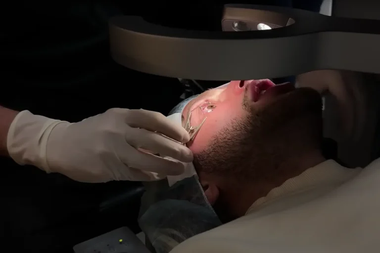 vad är lasik