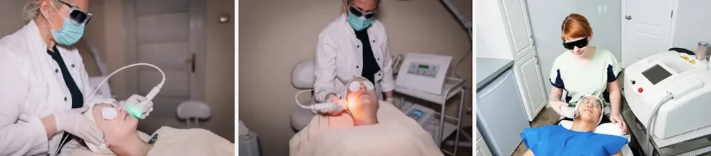 vad bör man undvika efter en laserbehandling för akne