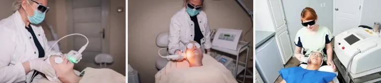vad bör man undvika efter en laserbehandling för akne