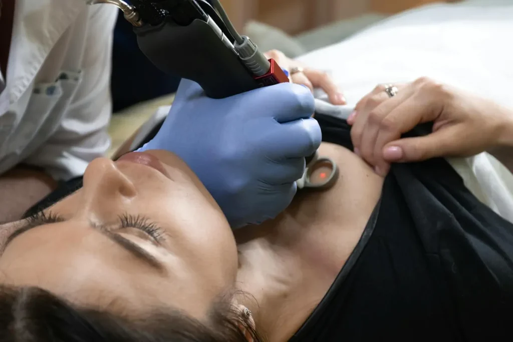 Brännskador efter laserbehandling