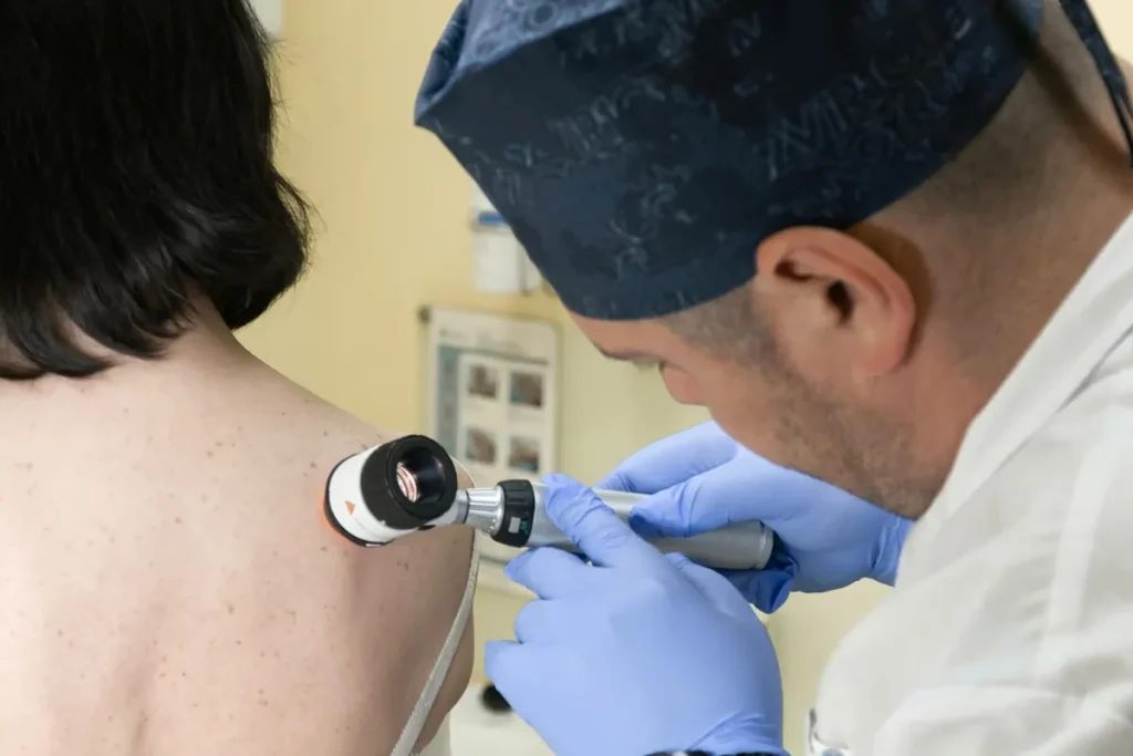 Rodnad efter laserbehandling