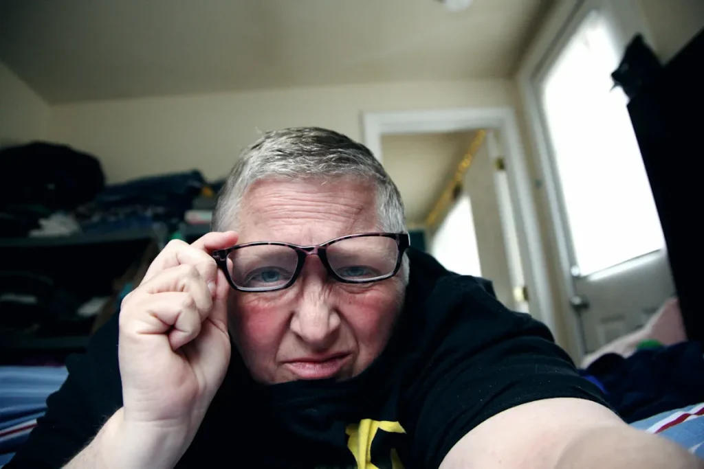 Laserbehandlingar för att förbättra hudens utseende efter respiratoriska sjukdomar