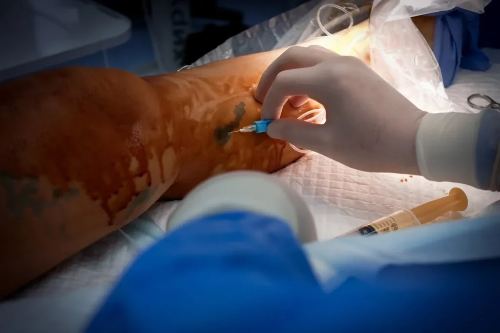 Laserbehandlingar för att förbättra hudens utseende efter kirurgi