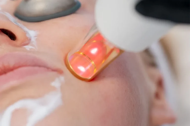 icke ablativ laser
