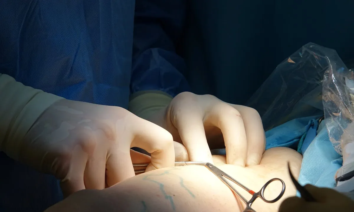 Laserbehandling för hudförbättring efter kirurgi
